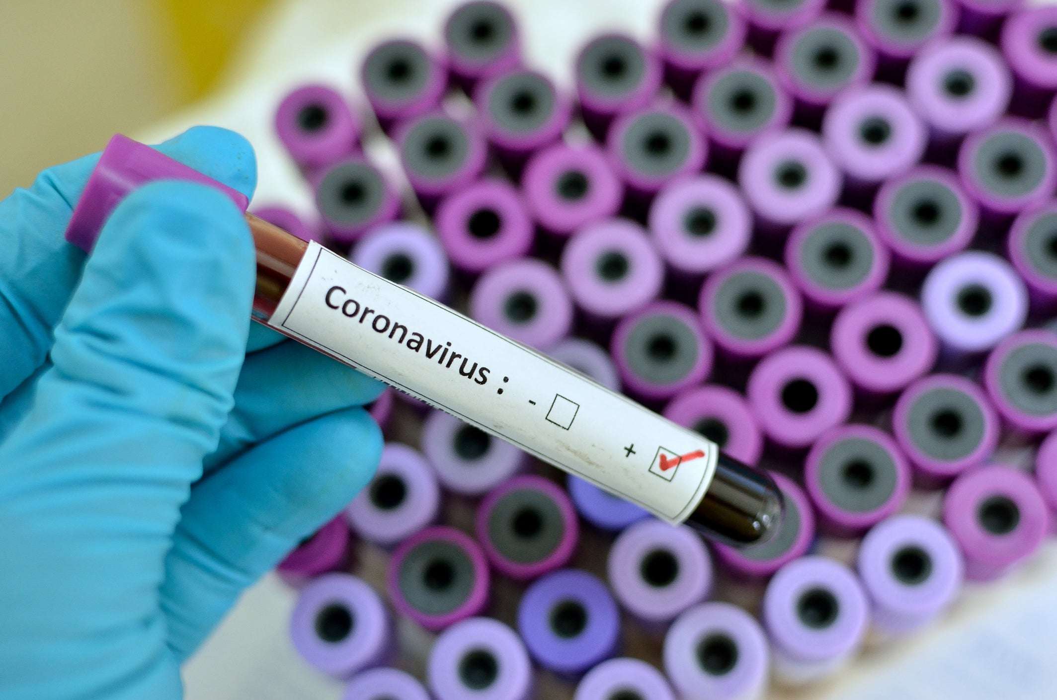 coronavirus-vial